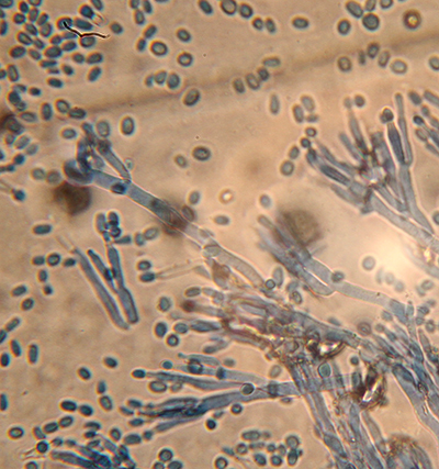 Penicillium